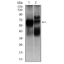 Beta-Hexosaminidase Subunit Alpha (HEXA) Antibody