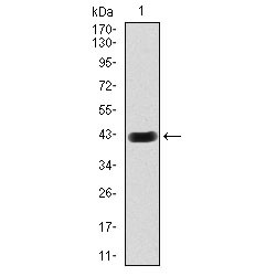 Beta-Hexosaminidase Subunit Alpha (HEXA) Antibody