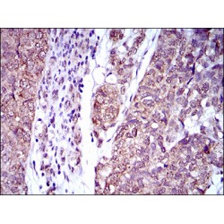 Interleukin 2 Receptor Alpha (IL2RA) Antibody