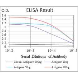 Interleukin 3 Receptor alpha (IL3RA) Antibody