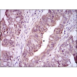 Integrin Alpha IIb / CD41 (ITGA2B) Antibody