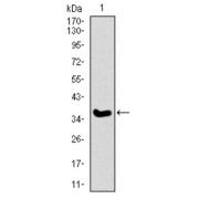 Western blot analysis using ITGA2B antibody against human ITGA2B recombinant protein. (Expected MW is 36.9 kDa).