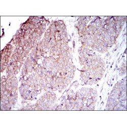 Integrin Beta 4 (ITGb4) Antibody