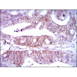 Lipoprotein A (LPA) Antibody