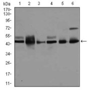 Western blot analysis using MAPK8 antibody against human MAPK8 (AA: 227-380) recombinant protein. (Expected MW is 43.4 kDa).