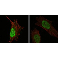 Protein Mdm4 (MDM4) Antibody