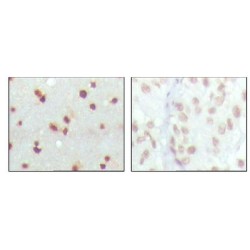 Protein Mdm4 (MDM4) Antibody