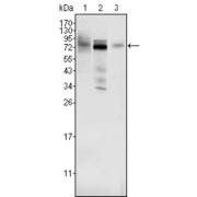 Western blot analysis using MDM4 antibody against Hela (1), A549 (2) and A431 (3) cell lysate.