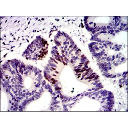 G/T Mismatch-Binding Protein (MSH6) Antibody