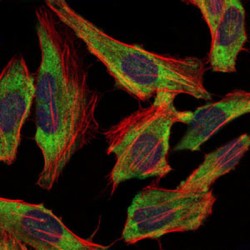 Neurofilament, Light Polypeptide (NEFL) Antibody