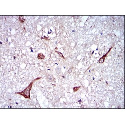 Neurofilament, Light Polypeptide (NEFL) Antibody