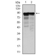 Western blot analysis using NEFL antibody against HeLa (1) and Jurkat (2) cell lysate.