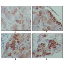 Retrotransposon-Derived Protein PEG10 (PEG10) Antibody