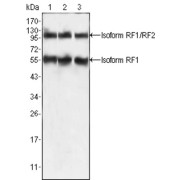 Western blot analysis using PEG10 antibody against HepG2 (1), SMMC-7721 (2) and A549 (3) cell lysate.