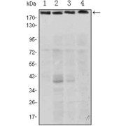 Western blot analysis using RICTOR antibody against Hela (1), PANC-1 (2), MOLT4 (3), and HepG2 (4) cell lysate.