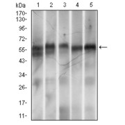 Western blot analysis using RING1 antibody against human RING1 recombinant protein. (Expected MW is 44.6 kDa).