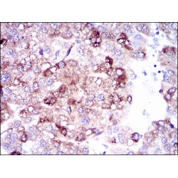 Bile Acyl-CoA Synthetase (SLC27A5) Antibody