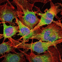 Mothers Against Decapentaplegic Homolog 2 (SMAD2) Antibody