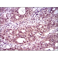 T-Box Transcription Factor T (TBXT) Antibody