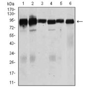 Western blot analysis using TGFBR3 antibody against human TGFBR3 recombinant protein. (Expected MW is 44.1 kDa).