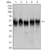 Western blot analysis using TUBB2A antibody against human TUBB2A recombinant protein. (Expected MW is 43.2 kDa).