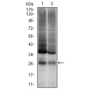 Western blot analysis using UBB antibody against human UBB (AA: 1-299) recombinant protein. (Expected MW is 26 kDa).