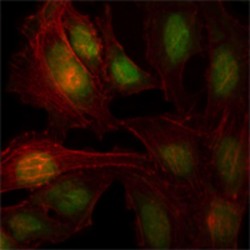 Zinc Finger And BTB Domain-Containing Protein 7B (ZBTB7B) Antibody