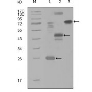 Western blot analysis using MAP4K4 antibody against truncated Trx-MAP4K4 recombinant protein (1), MBP-MAP4K4 (aa300-400) recombinant protein (2) and MAP4K4 (aa194-436) -hIgGFc transfected CH0-K1 cell lysate (3).