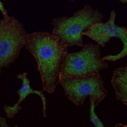 RAB25, Member RAS Oncogene Family (Rab25) Antibody
