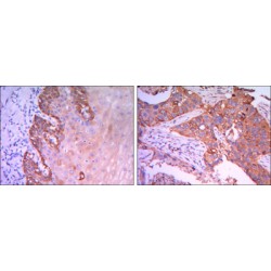RAB25, Member RAS Oncogene Family (Rab25) Antibody