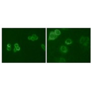 Immunofluorescence analysis of Hela (Left) and MCF-7 (Right) cells using Tyro3 antibody (green).