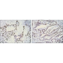 Proliferation Marker Protein Ki-67 (MKI67) Antibody