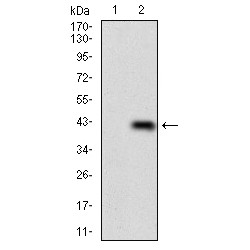 Zinc Finger Protein PLAGL1 (PLAGL1) Antibody