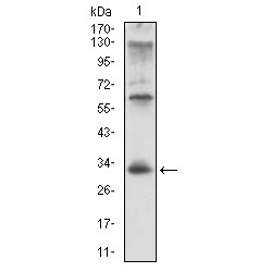 HLA Class II Histocompatibility Antigen Gamma Chain (CD74) Antibody