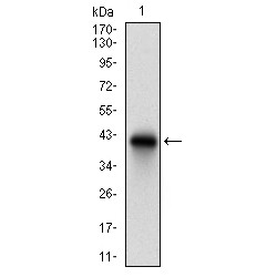 HLA Class II Histocompatibility Antigen Gamma Chain (CD74) Antibody