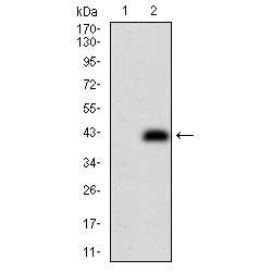 HLA Class II Histocompatibility Antigen Gamma Chain (CD74) Antibody