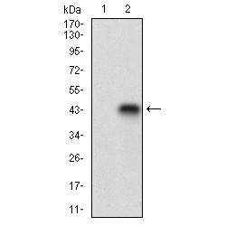 Homeobox Protein CDX-1 (CDX1) Antibody