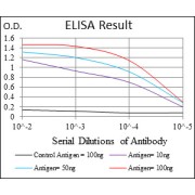 Fig. 1. Black line: Control Antigen (100 ng); Purple line: Antigen(10ng); Blue line: Antigen (50 ng); Red line: Antigen (100 ng)