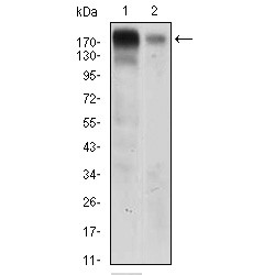 Epidermal Growth Factor Receptor (EGFR) Antibody