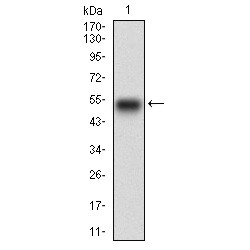 Epidermal Growth Factor Receptor (EGFR) Antibody