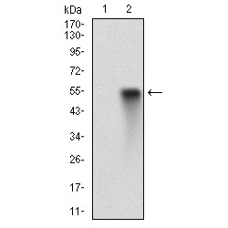 Epidermal Growth Factor Receptor (EGFR) Antibody