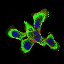 E3 Ubiquitin-Protein Ligase RING1 (Ring1) Antibody