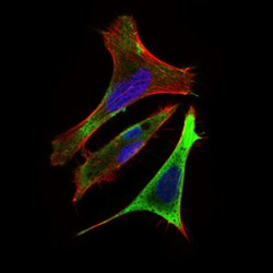 E3 Ubiquitin-Protein Ligase RING1 (Ring1) Antibody