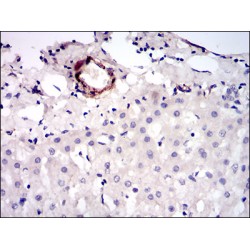 Melanoma Cell Adhesion Molecule (MCAM) Antibody