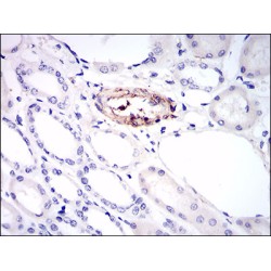 Melanoma Cell Adhesion Molecule (MCAM) Antibody