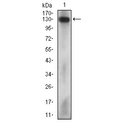 Melanoma Cell Adhesion Molecule (MCAM) Antibody