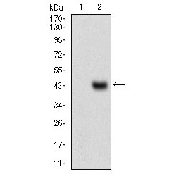 Melanoma Cell Adhesion Molecule (MCAM) Antibody