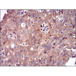 DIS3-Like Exonuclease 2 (DIS3L2) Antibody