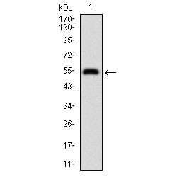 DIS3-Like Exonuclease 2 (DIS3L2) Antibody