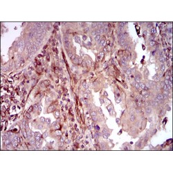 Mitogen-Activated Protein Kinase 14 (MAPK14) Antibody